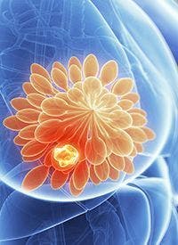Alisertib in 

Endocrine-Resistant 

Advanced Breast Cancer | 

Image Credit: © SciePro 

- stock.adobe.com
