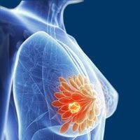 CYP2D6 Genotype Linked With Suboptimal Outcomes in Breast Cancer