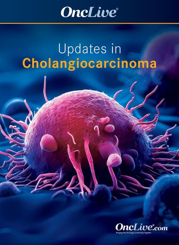 Updates in Cholangiocarcinoma