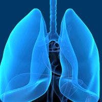Dinutuximab Misses Survival Endpoint in Small Cell Lung Cancer