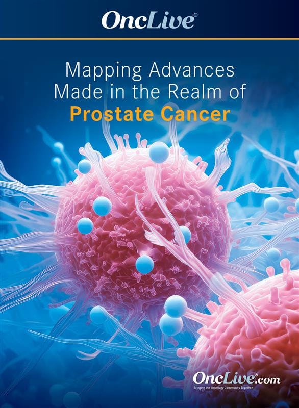 Mapping Advances Made in the Realm of Prostate Cancer