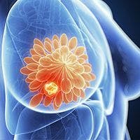 The combination of the targeted immunotherapy Bria-IMT and retifanlimab demonstrated signs of clinical benefit and was found to be well tolerated in patients with advanced metastatic breast cancer.