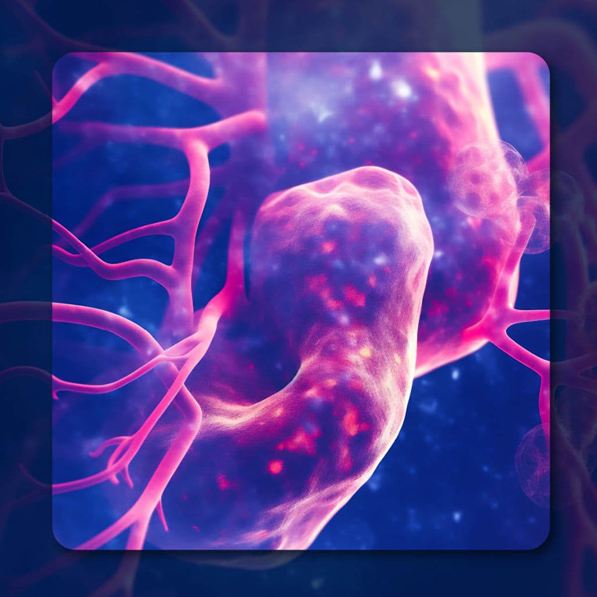 THIO Plus Cemiplimab in Checkpoint Inhibitor–Resistant NSCLC | Image Credit: © catalin - stock.adobe.com