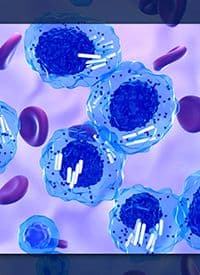 Revumenib in NPM1+ R/R AML | Image Credit: © LASZLO– stock.adobe.com