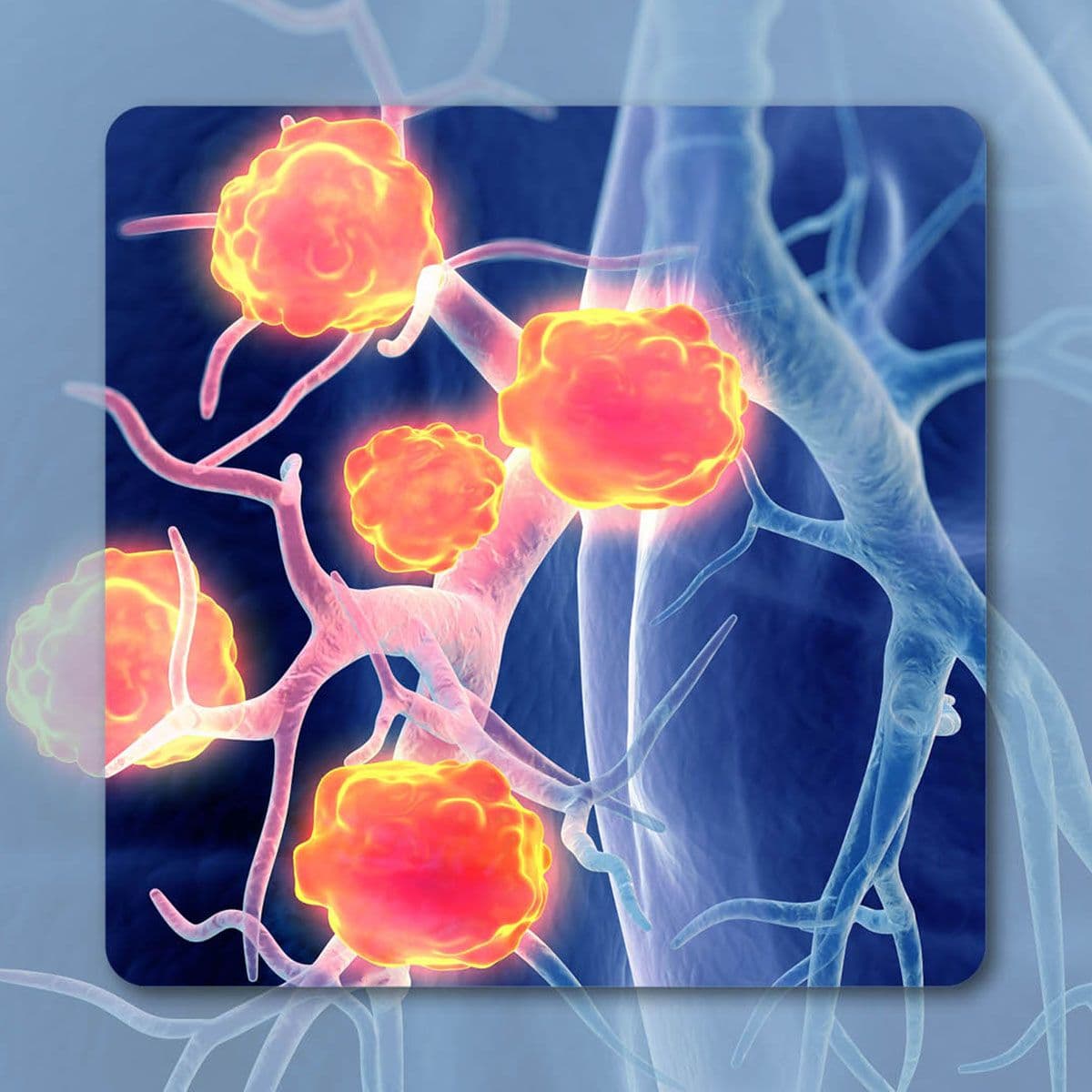 Lung cancer, Image credit: Axel Kock – stock.adobe.com